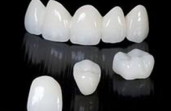 Виды зубных имплантов и их особенности